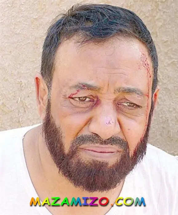 أحدث صورة لعبدالإمام عبدالله
